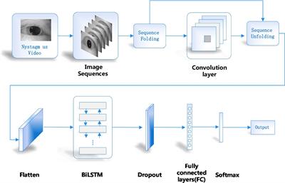 Torsional nystagmus recognition based on deep learning for vertigo diagnosis